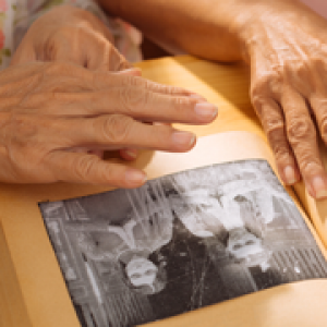 Cuidados de terapia ocupacional para personas mayores con demencia